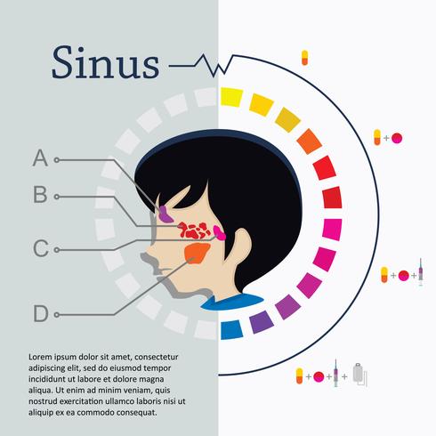 Flaches Gesicht und Sinus Illustration vektor