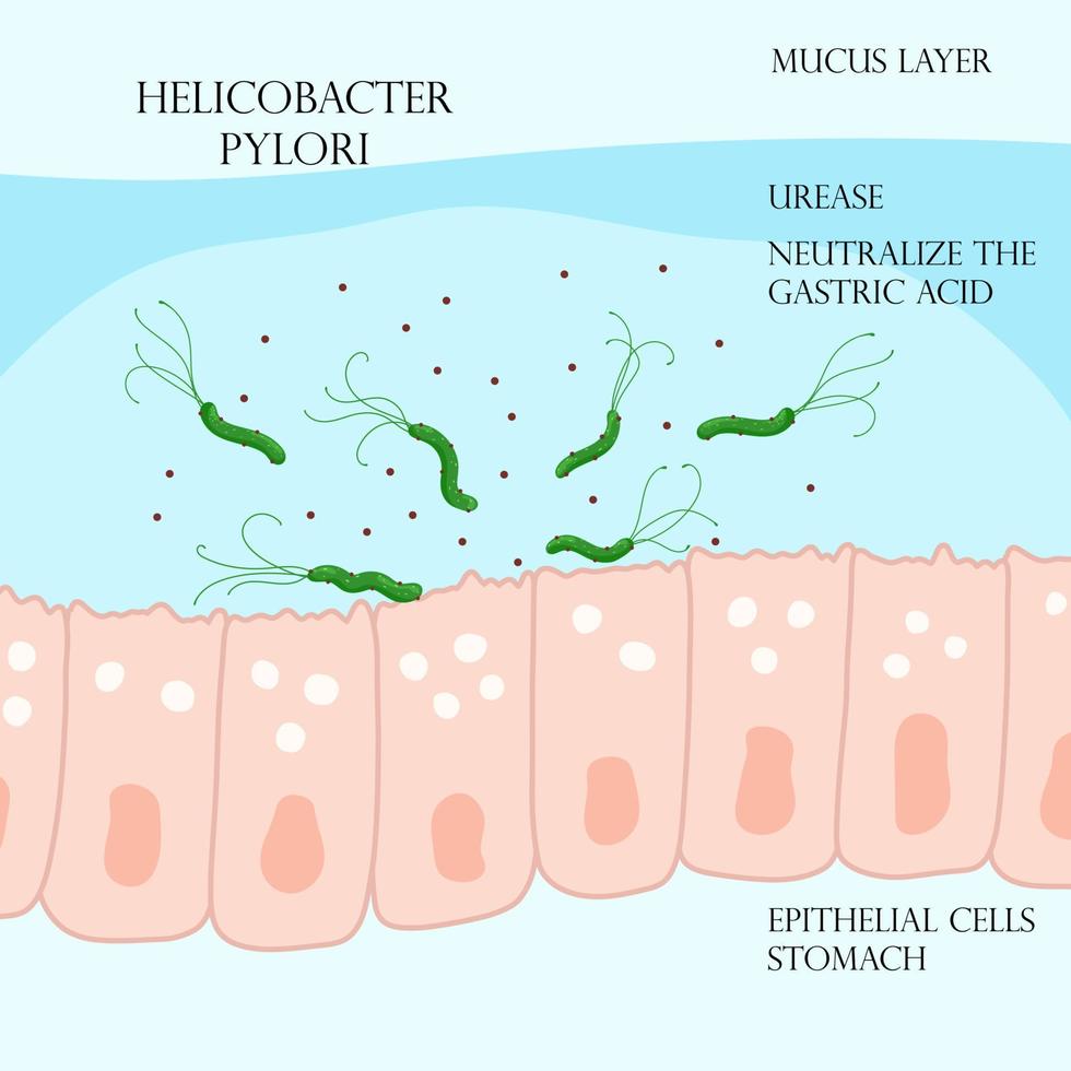 helicobacter pylori i slemhinna lager på epitel celler i mage vektor