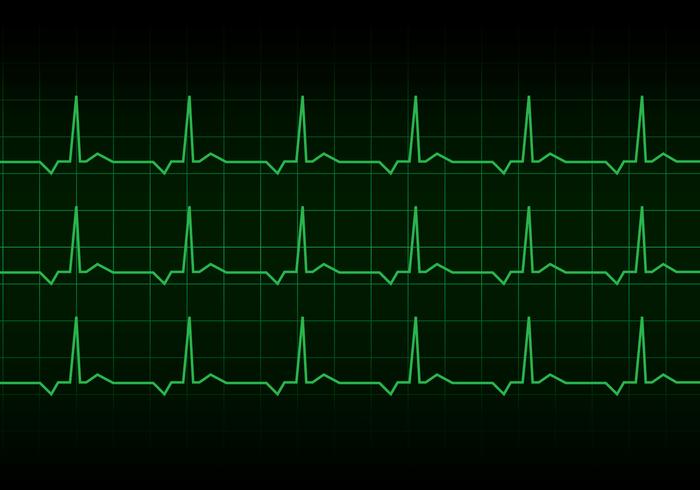 Heartbeat Heart Rhythm Monitor Vector