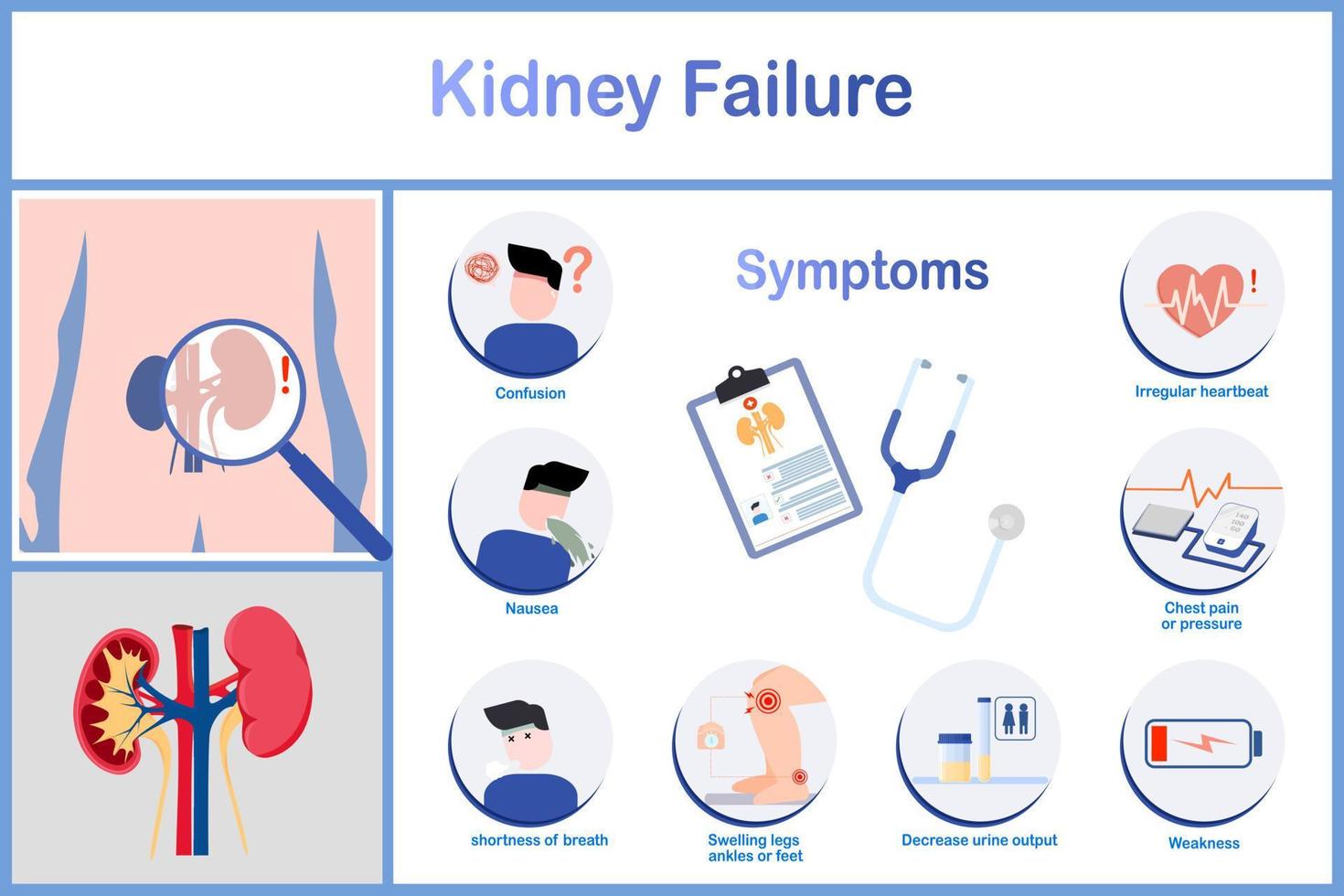 vektorillustration.symptome von nierenversagen, einschließlich übelkeit und erbrechen, unregelmäßiger herzschlag, vermindertes wasserlassen, brustschmerzen und druck.einschließlich ödeme.flat stye.healthcare und medizinisches konzept. vektor