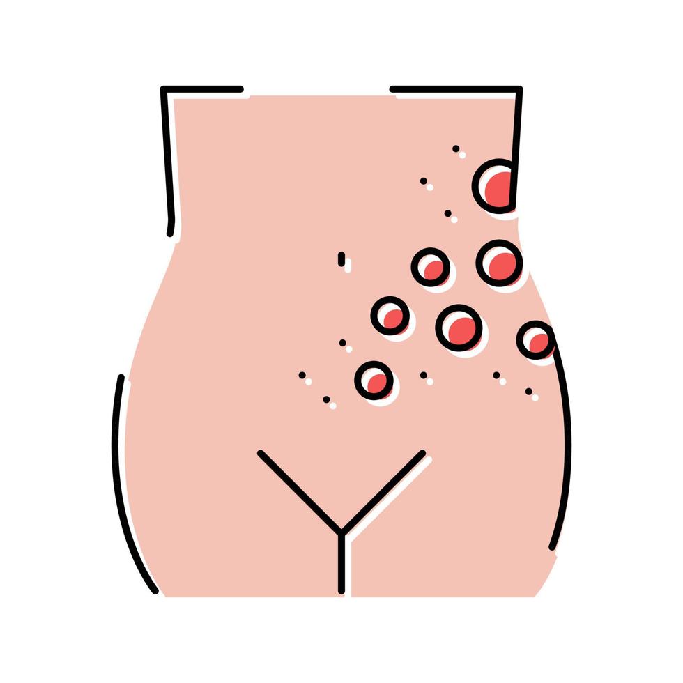 Flechte Gürtelrose Krankheit Farbe Symbol Vektor Illustration