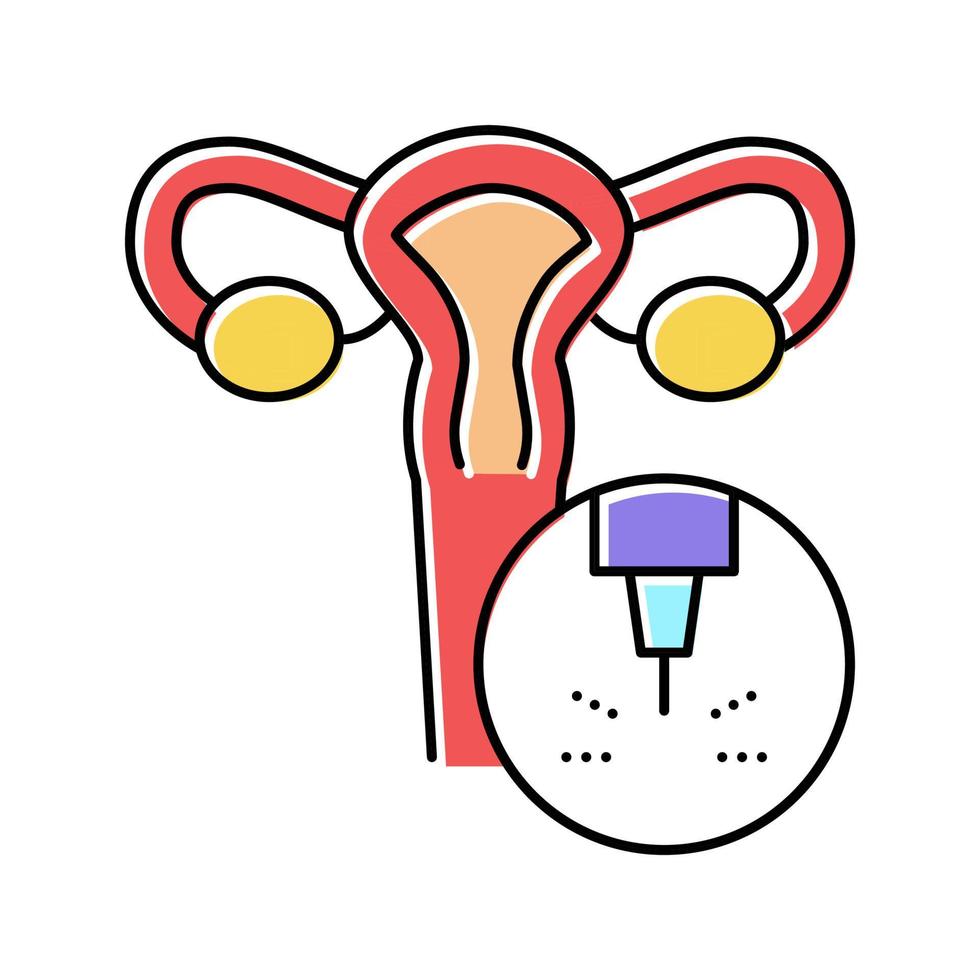 Uterus medizinische Laserbehandlung Farbe Symbol Vektor Illustration