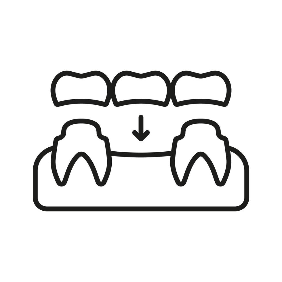 dental bro linje ikon. ortodontisk tänder implantera linjär piktogram. oral vård. stomatologi protes. tandvård översikt symbol. dental behandling tecken. redigerbar stroke. isolerat vektor illustration.