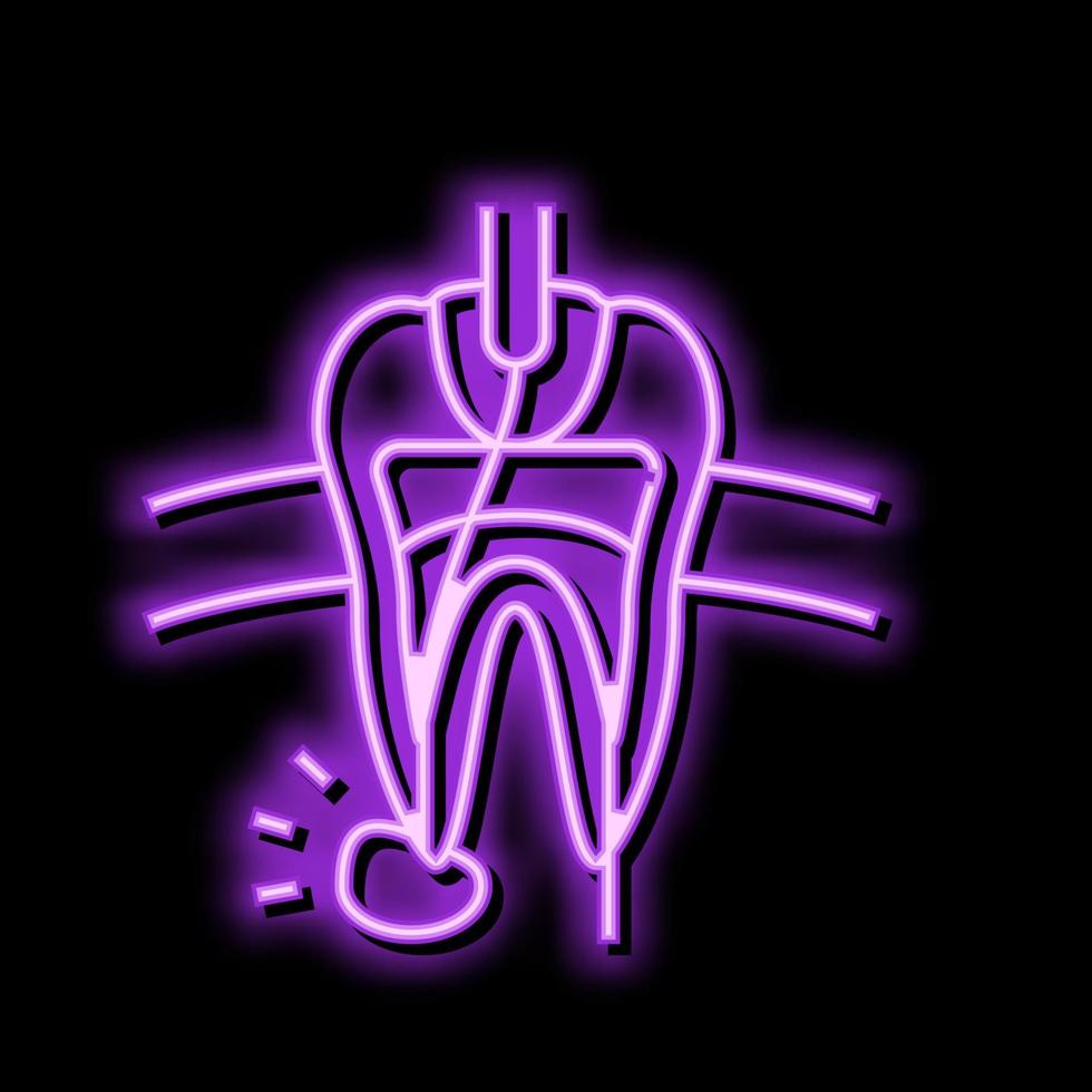 Wurzel Kanal Behandlung Neon- glühen Symbol Illustration vektor