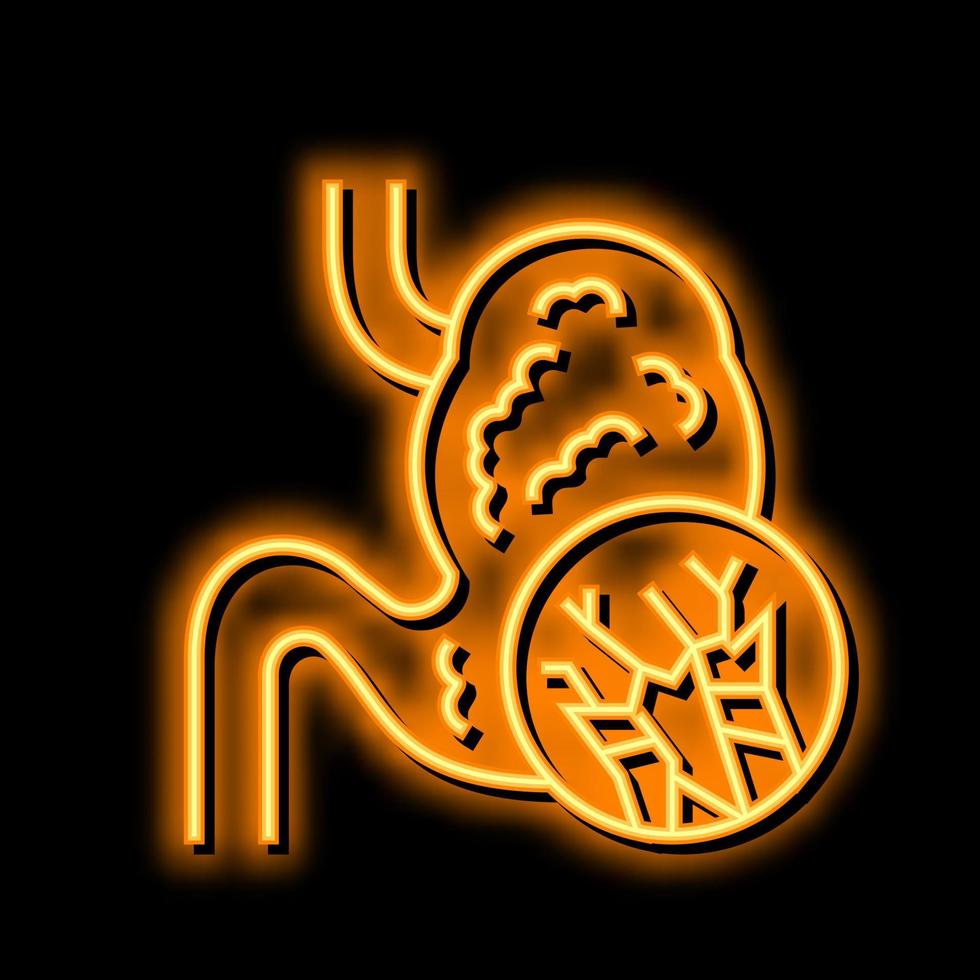 abdominal svullnad mesoteliom neon glöd ikon illustration vektor