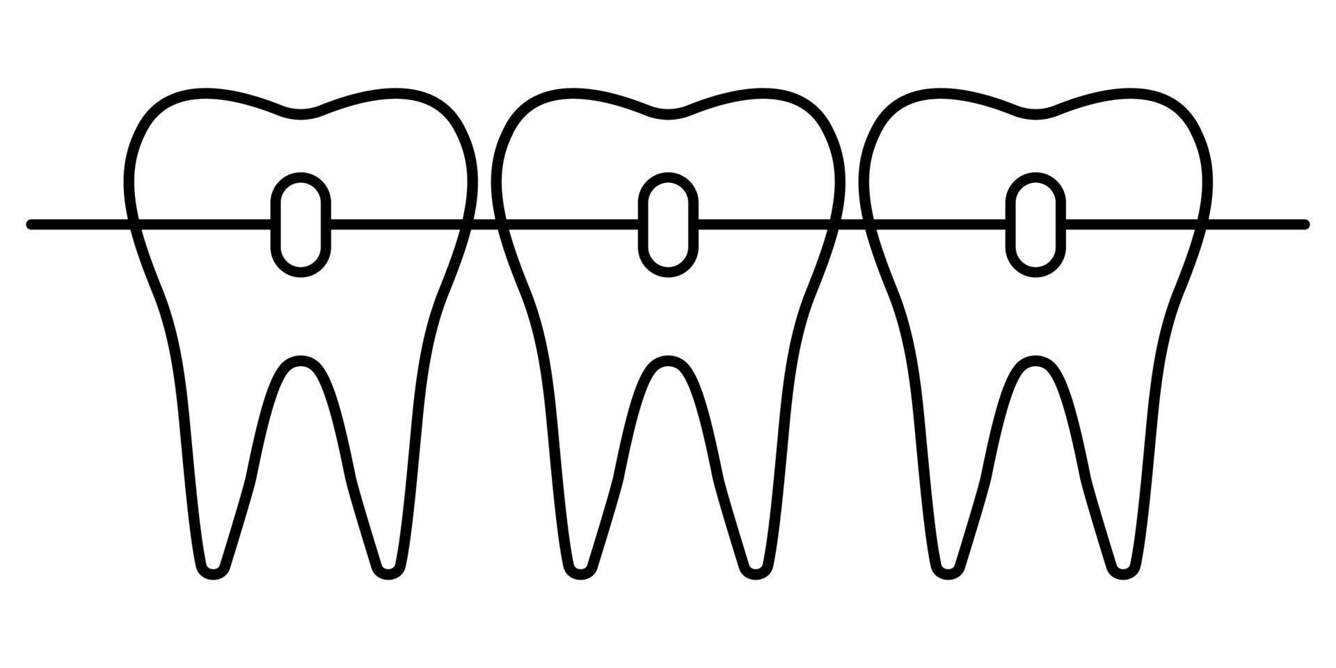 Dental Hosenträger Symbol, kieferorthopädisch Zähne Ausrichtung zum ein schön Lächeln vektor