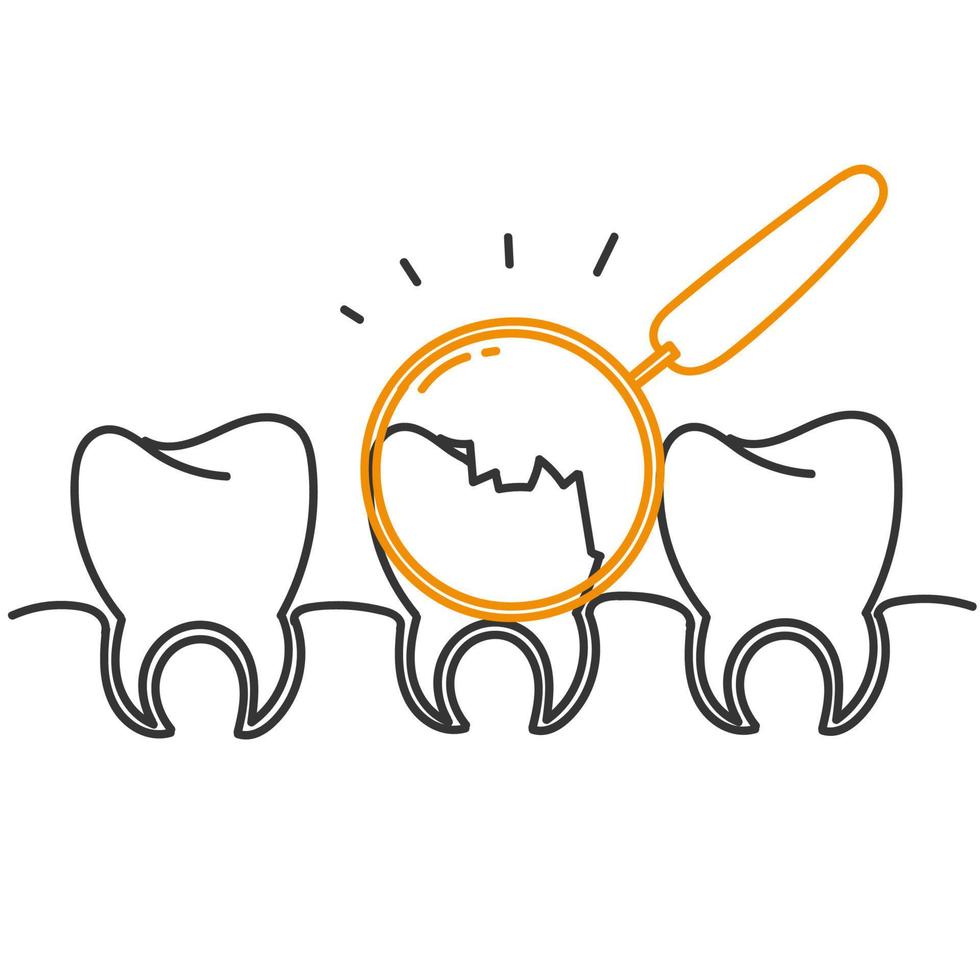 Hand gezeichnet Gekritzel Hohlraum Zahn mit Vergrößerung Glas Illustration vektor