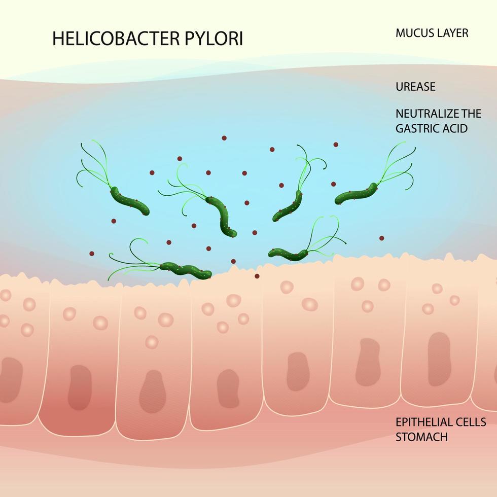 helicobacter pylori bakterie i slemhinna lager av mänsklig mage vektor