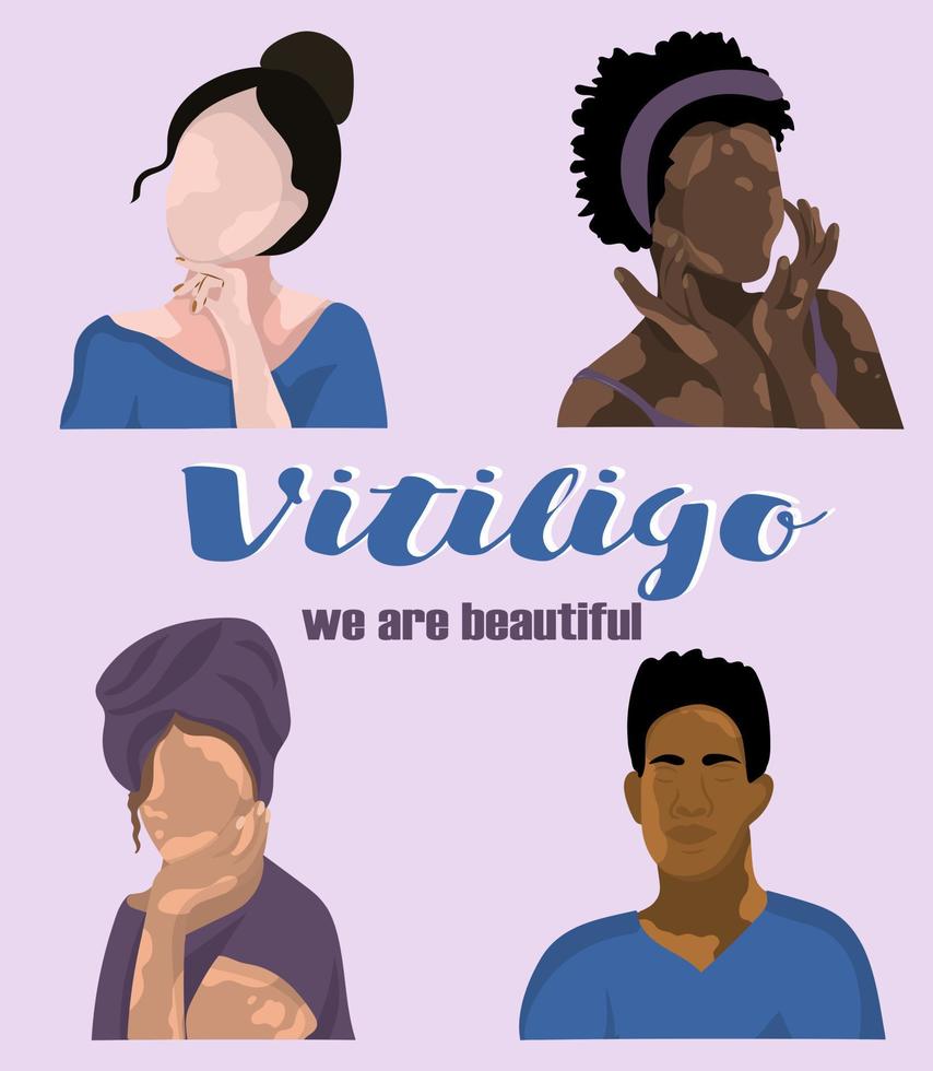 ung kille och flickor med vitiligo hud problem vektor