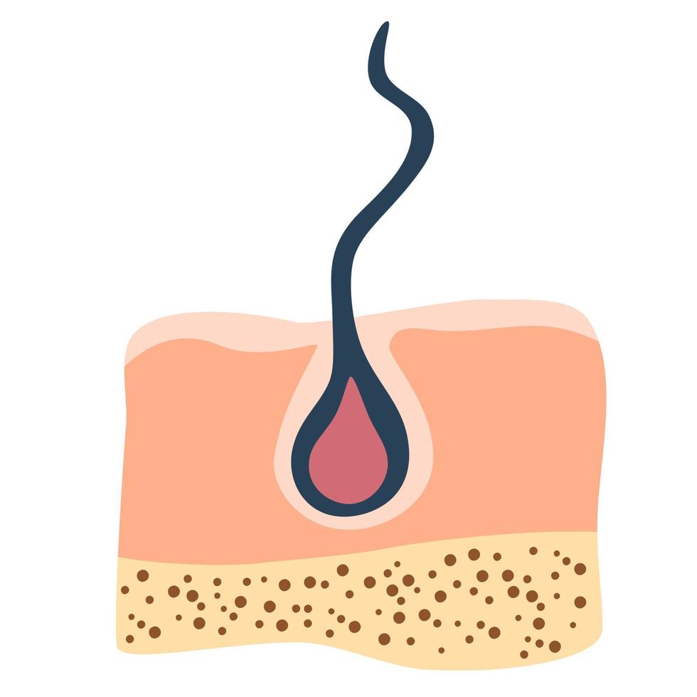 normal Haar Wachstum. Entzündung, Haut Probleme. Anatomie Infografiken von Haar. Vektor Illustration isoliert auf das Weiß Hintergrund.