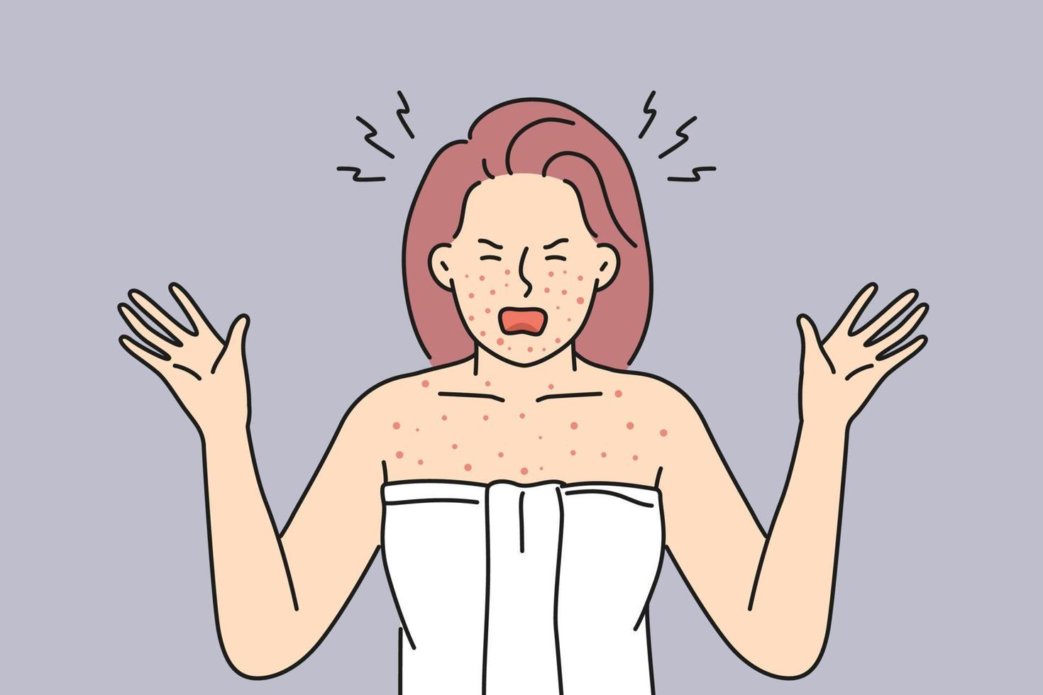 arg kvinna i handduk skrika bedrövad med röd kropp inflammation. rasande kvinna angelägen med allergi reaktion eller dermatit. vektor illustration.