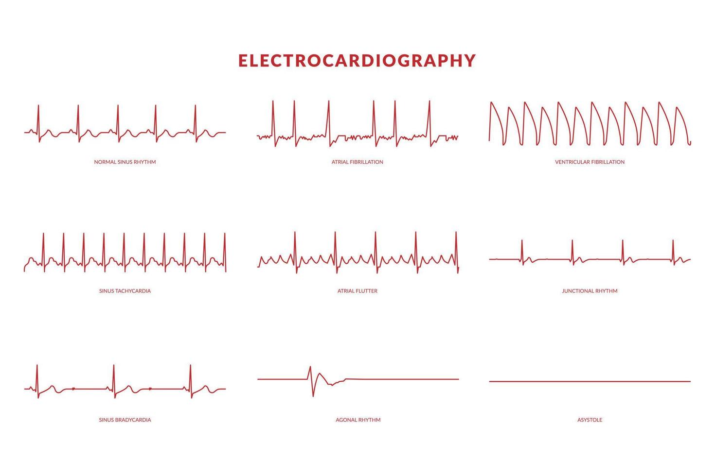 elektrokardiografi hjärtslag linje övervaka. vektor eps10 illustration
