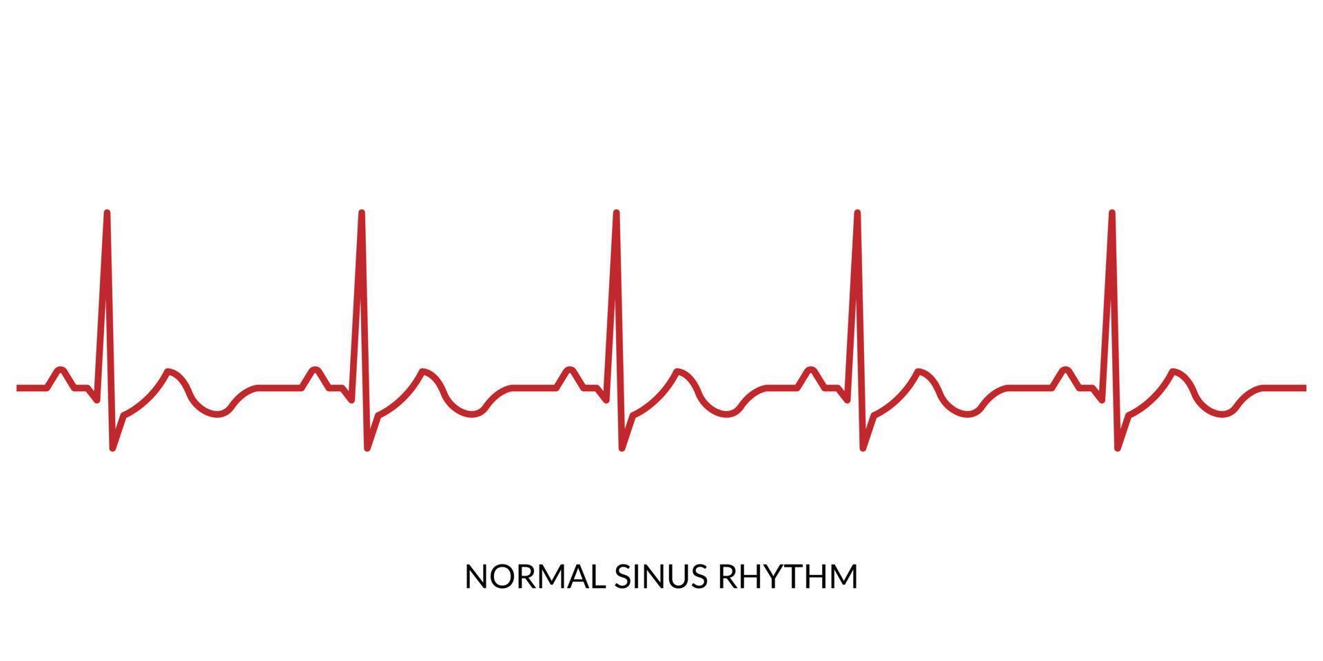 ecg hjärtslag linje. elektrokardiogram vektor illustration. vanligt sinus rytm