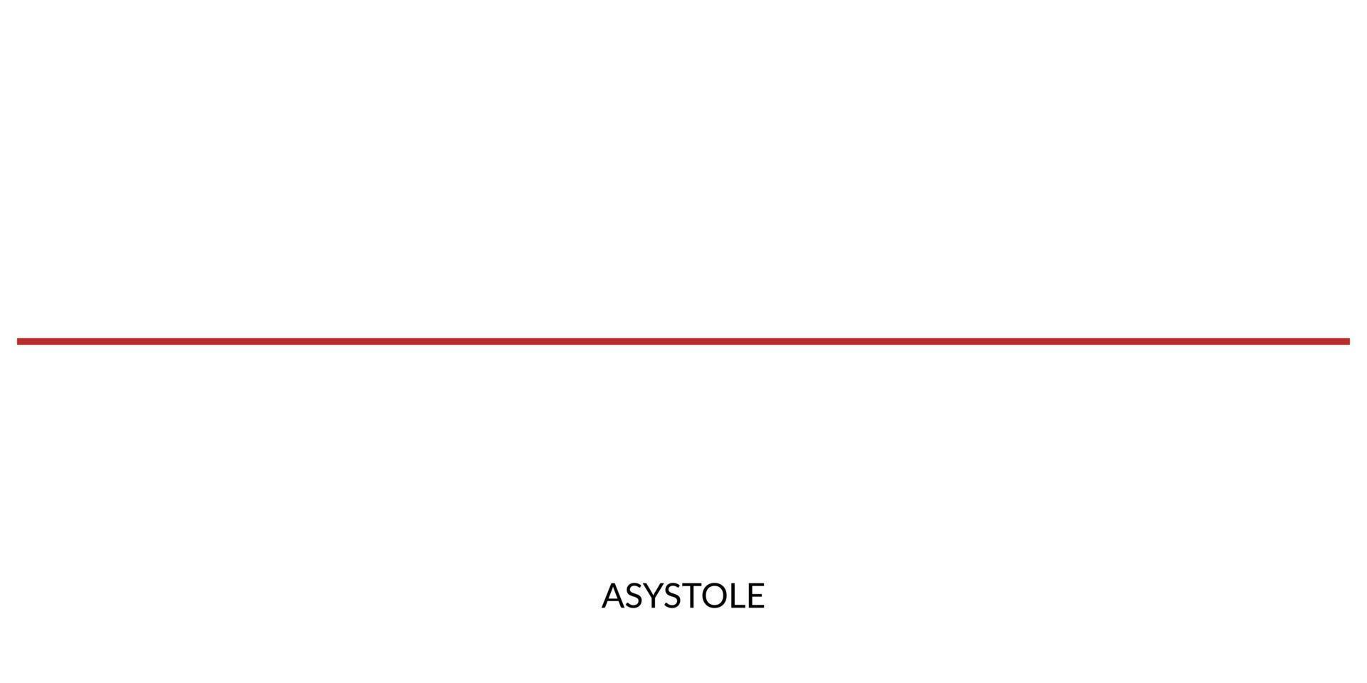 ecg hjärtslag linje. elektrokardiogram vektor illustration. asystole