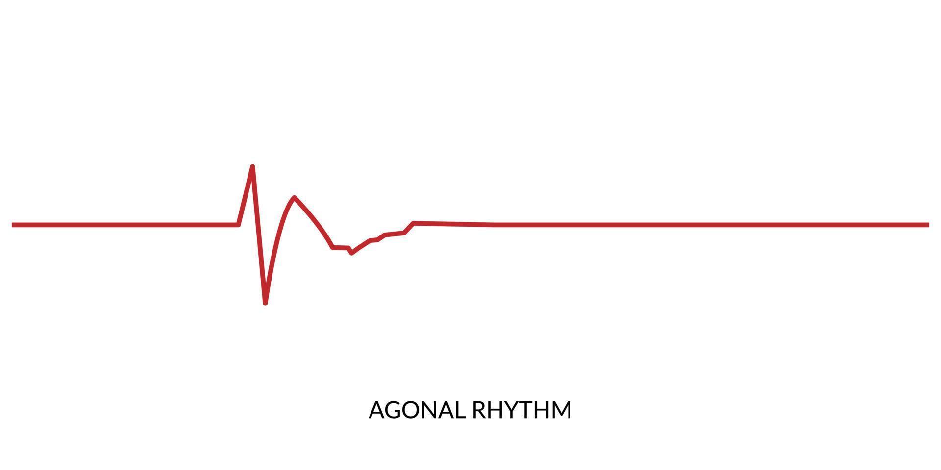 EKG Herzschlag Linie. Elektrokardiogramm Vektor Illustration. agonal Rhythmus