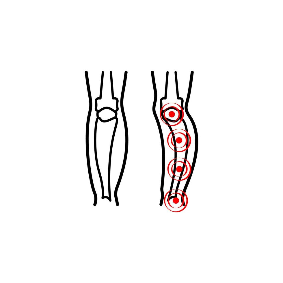 pagets sjukdom, smärta vektor ikon