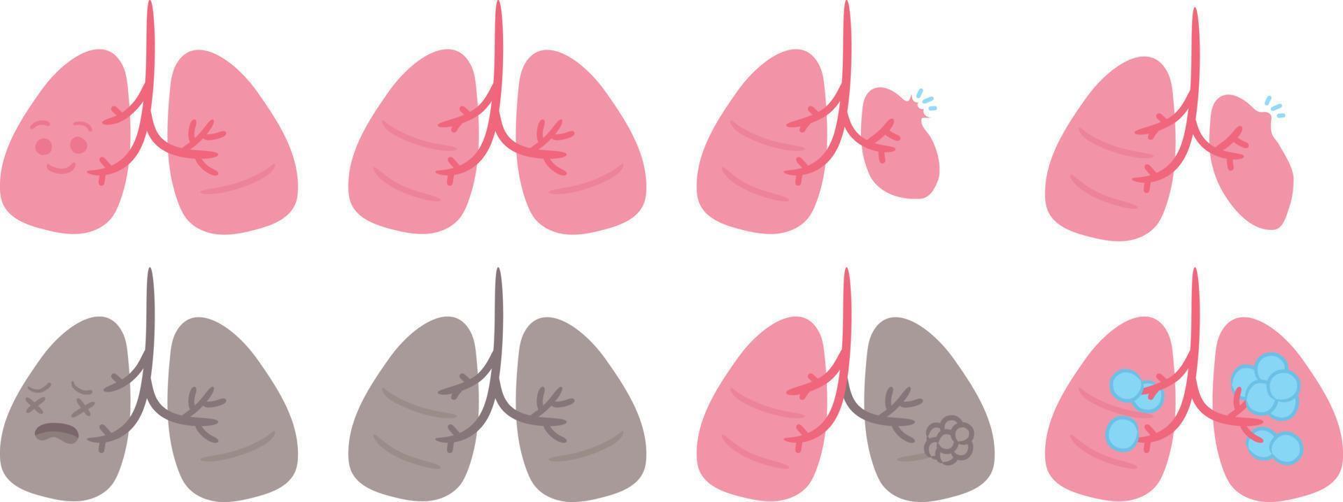 süß Mensch Organ Lunge Krankheit medizinisch Anatomie Karikatur Charakter vektor