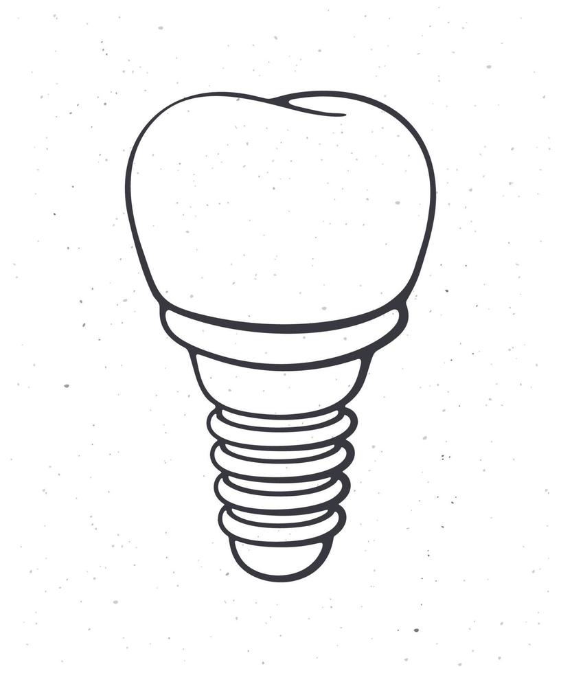 dental implantera av mänsklig tand. översikt. vektor illustration. symbol av somatologi och oral hygien. fixtur protes i tandvård. hand dragen skiss. isolerat vit bakgrund