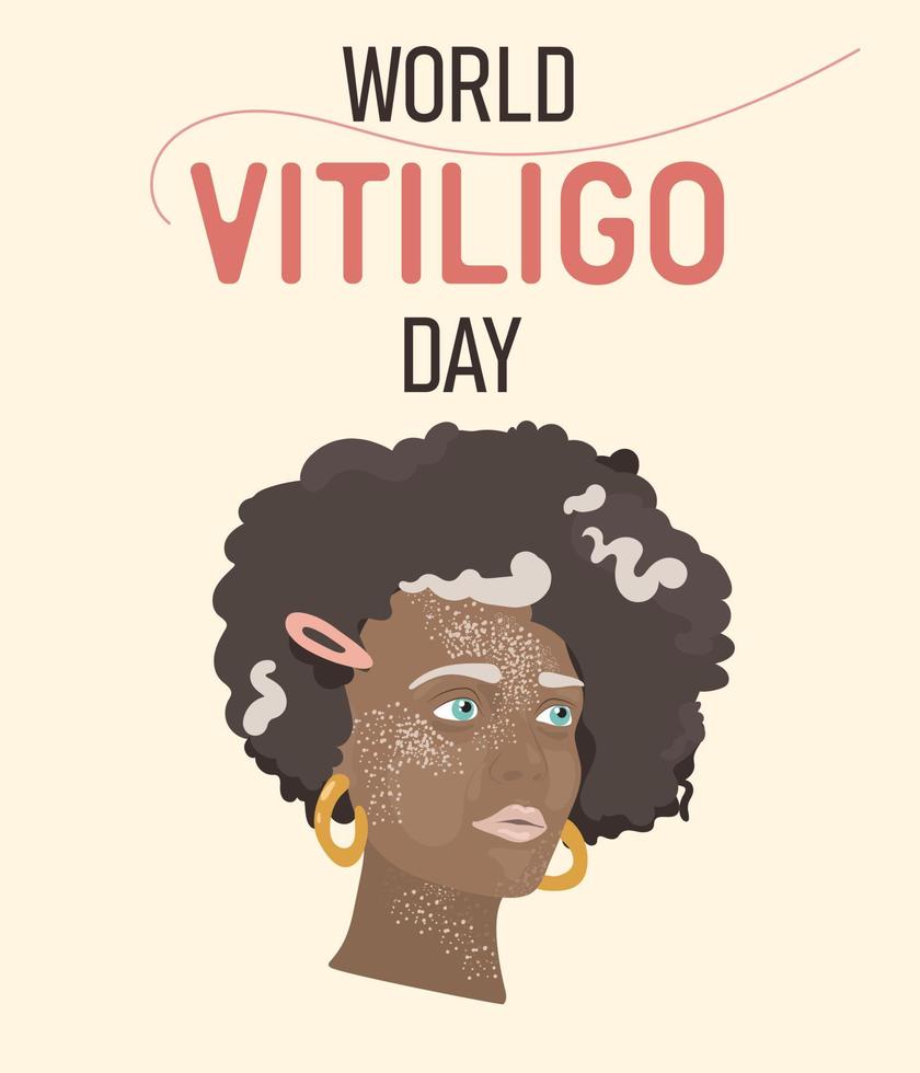 flicka med vitiligo.svart afrikansk flicka. vektor