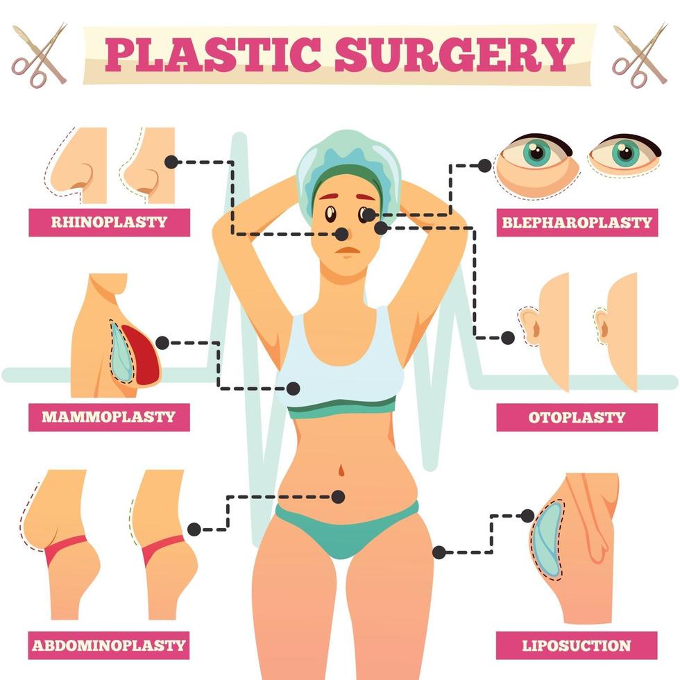 plastikkirurgi ortogonalt flödesschema vektorillustration vektor