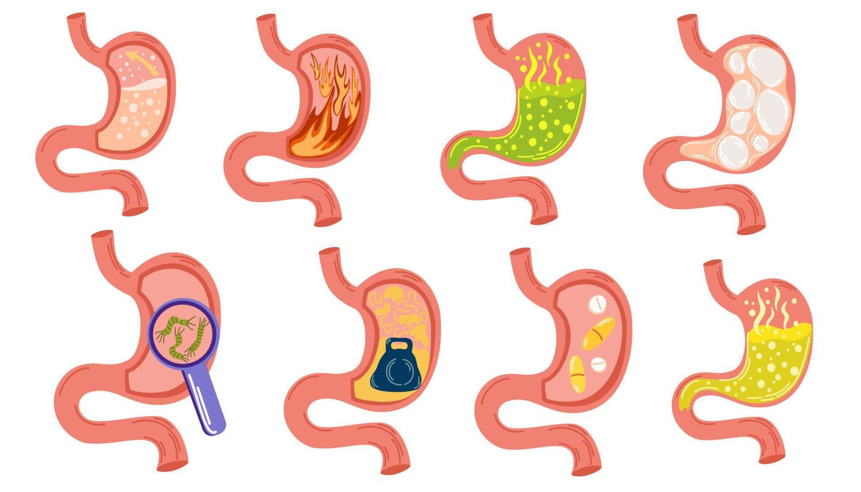 Bauch Krankheiten Satz. Aufblähen Bauch schmerzen, Verdauungs- Trakt Schmerzen Fülle Schwere Magen, Acid Sodbrennen Prozess Verdauungsstörungen Zwölffingerdarm Rückfluss. leeren und voll Magen. Vektor Illustration