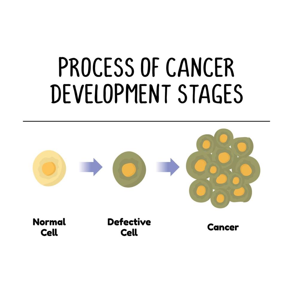 bearbeta av cancer utveckling stadier illustration på vit bakgrund. vektor