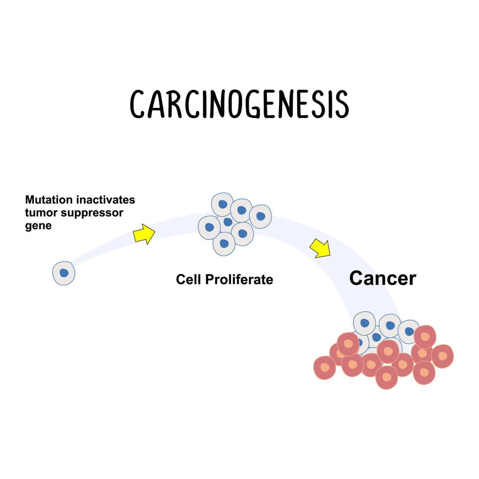 karcinogenes de bearbeta av cancer utveckling, vektor