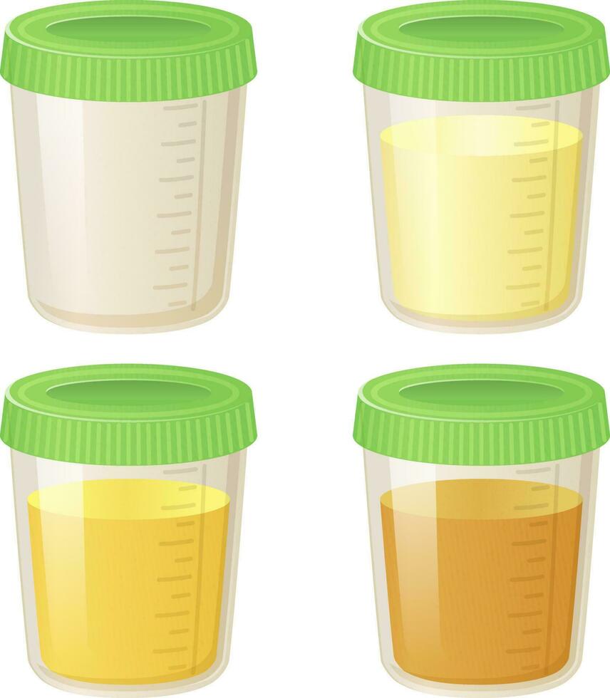 kissa i en plast behållare uppsättning. samling av urin analys ampuller i olika färger från klar till gul - platt tecknad serie stil vektor illustration
