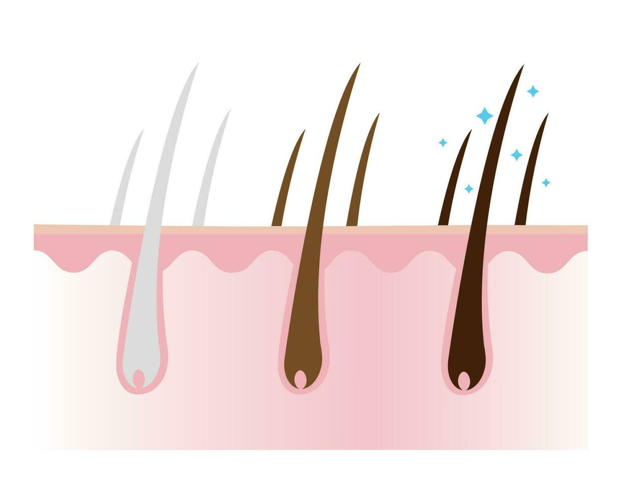 minska vit, grå hår och göra hår mörkare med skalp lager vektor isolerat på vit bakgrund. lösning för grånar och mörkare hår. hår vård begrepp illustration.