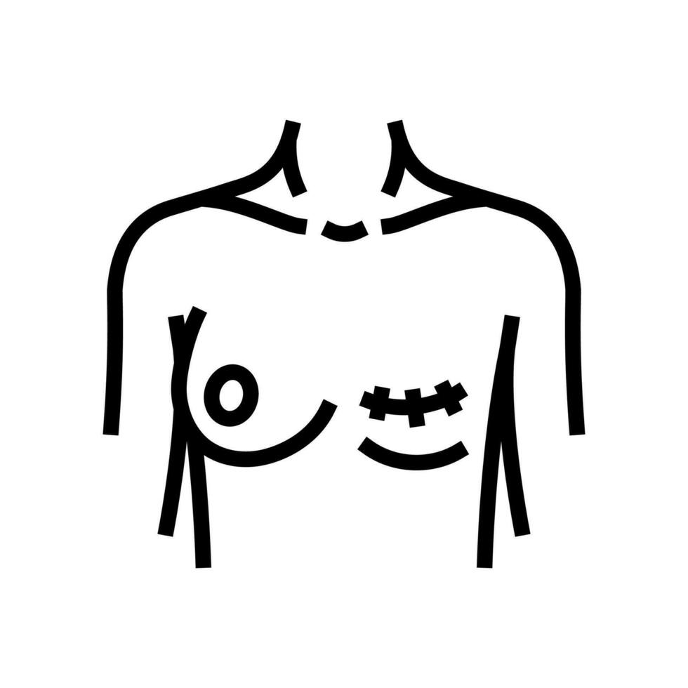 Mastektomie Chirurgie Chirurgie Linie Symbol Vektor Illustration