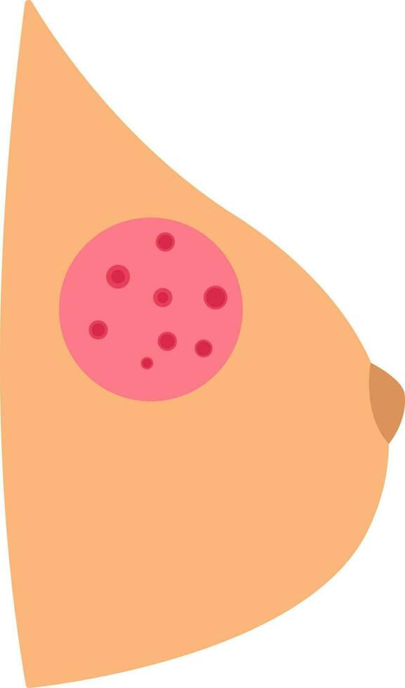 Brust Krebs Symbol oder Symbol im Pfirsich und rot Farbe. vektor