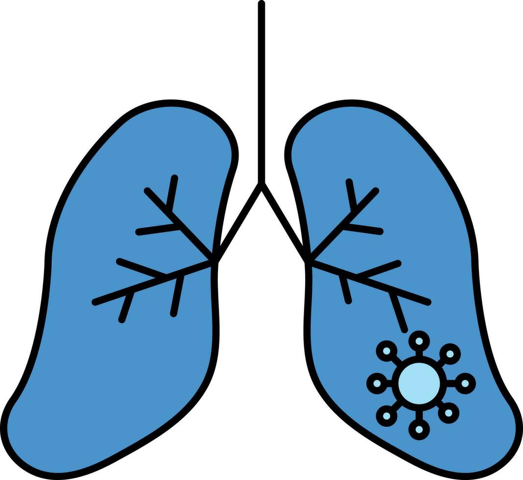 Virus infiziert Lunge Blau Symbol oder Symbol. vektor