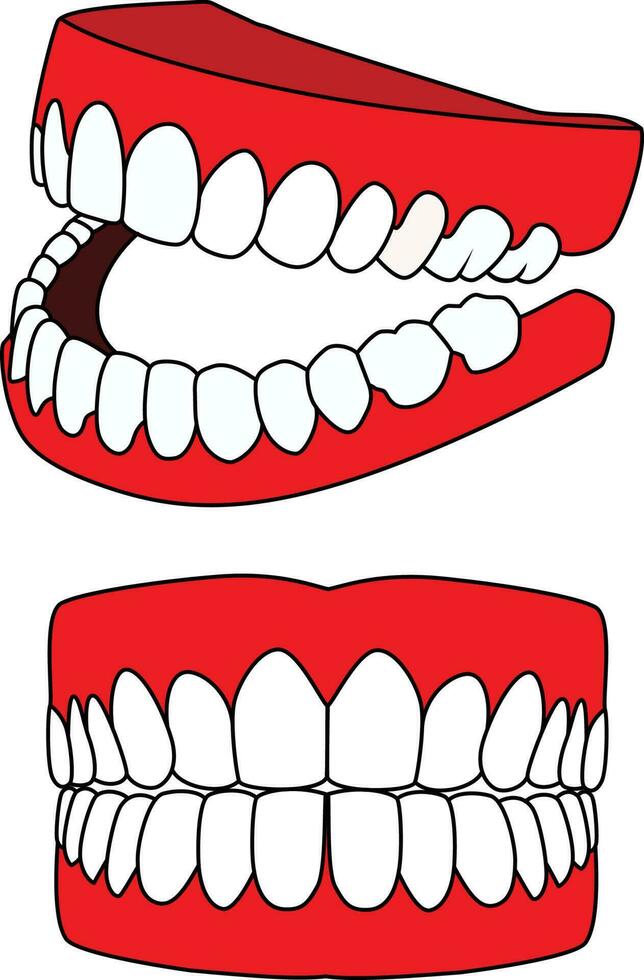Prothese im anders Winkel Vektor Illustration künstlich einstellen von Zähne Vektor Bild