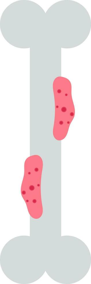 platt stil ben cancer ikon i grå och rosa Färg. vektor