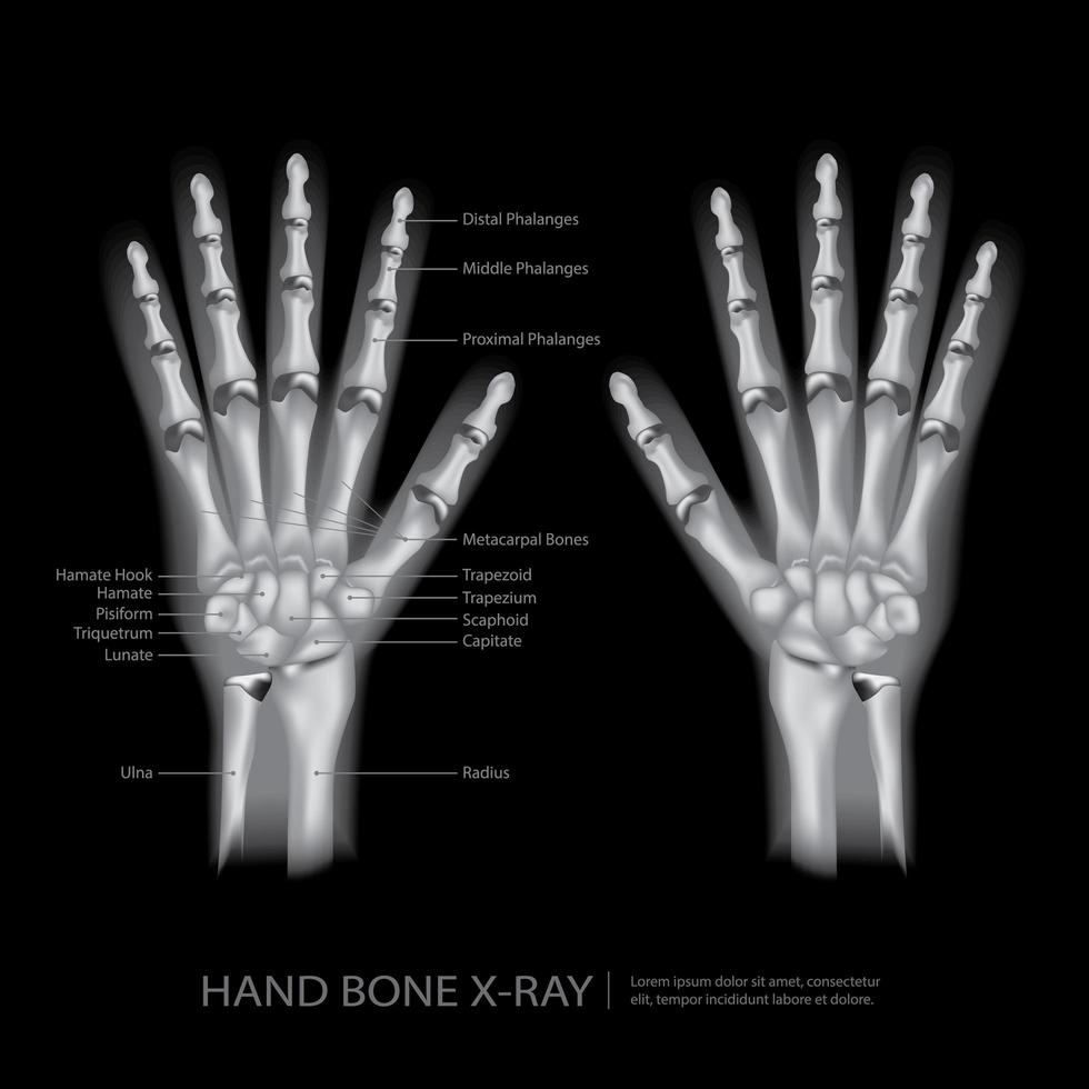 Handknochen-Röntgenvektorillustration vektor