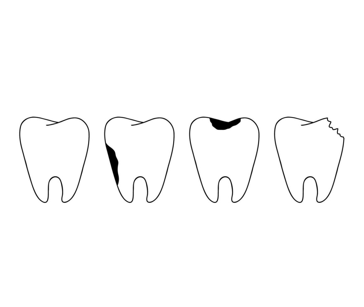 friska och sjuk tand översikt klotter ikoner uppsättning. tandvård, stomatologi och dental vård begrepp. vektor hand dragen skiss isolerat på vit bakgrund.