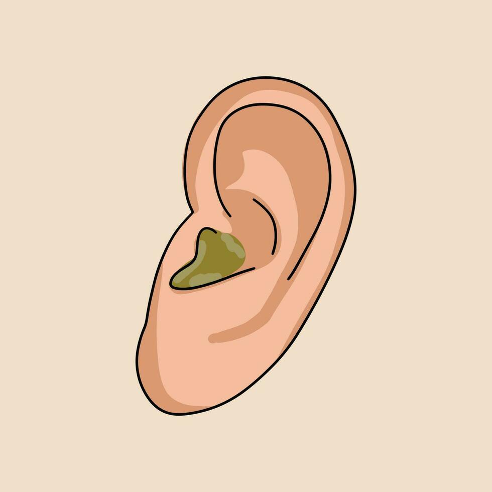 Otitis Ohr. Vektor Illustration im eben Stil