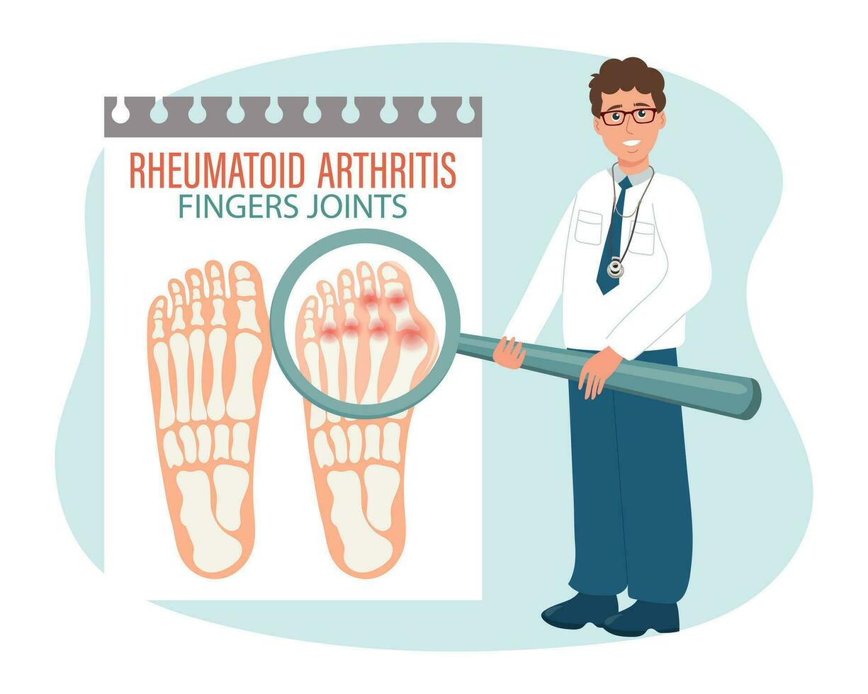 rheumatoide Arthritis. Arthrose von das Gelenke von das Zehen. männlich Arzt mit ein Vergrößerung Glas. medizinisch Infografik Banner, Poster, Vektor
