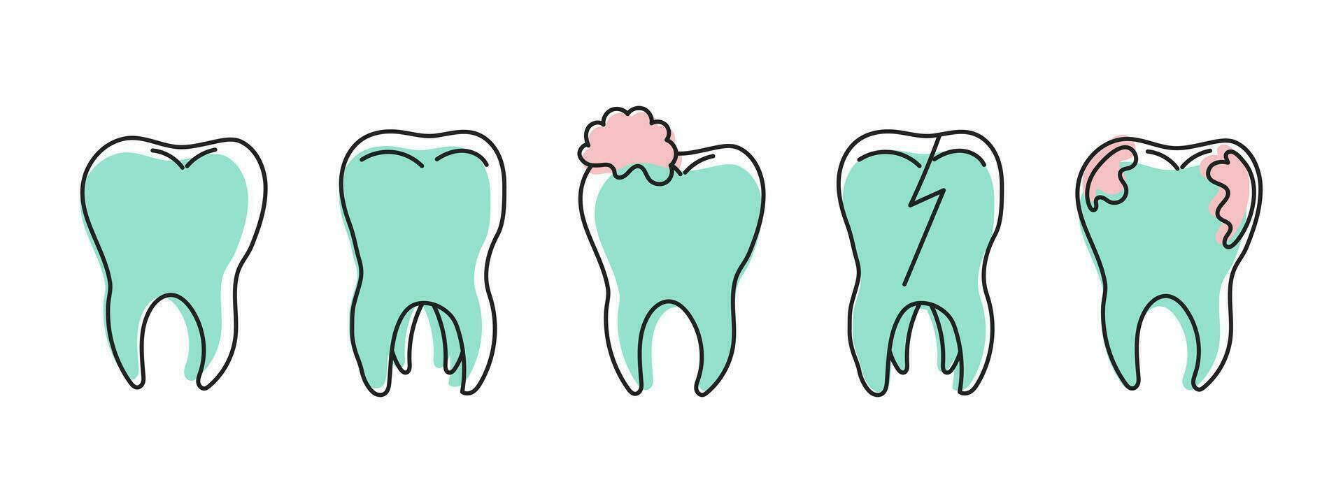 friska och ohälsosam tänder, tänder med karies, tandsten. dental vård. logotyp, linjär klotter ikoner, vektor