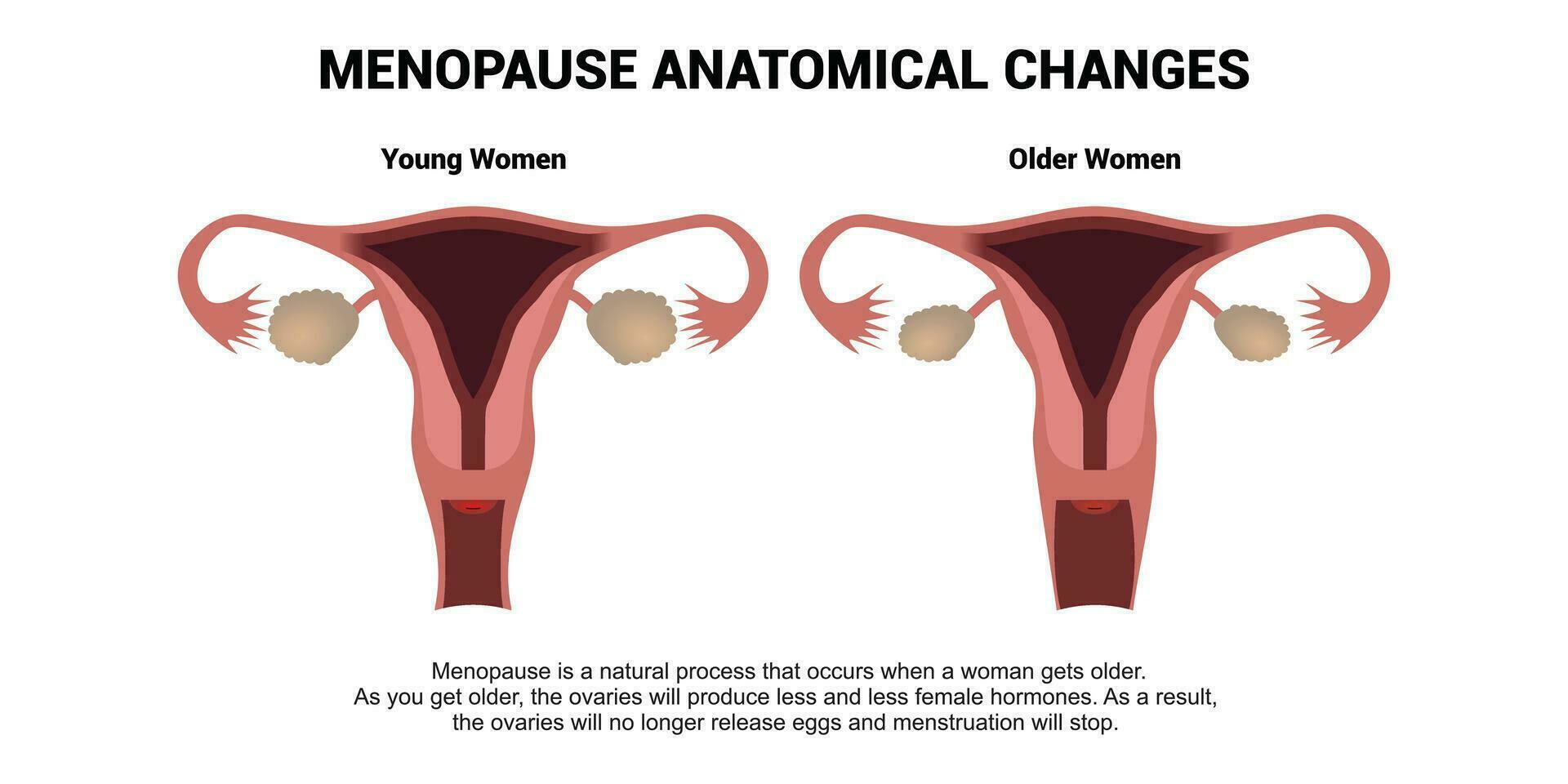 Menopause anatomisch Änderungen. Vergleich von weiblich reproduktiv System von jung Frau und älter Frau mit Erklärungen. realistisch Anatomie Vektor Illustration