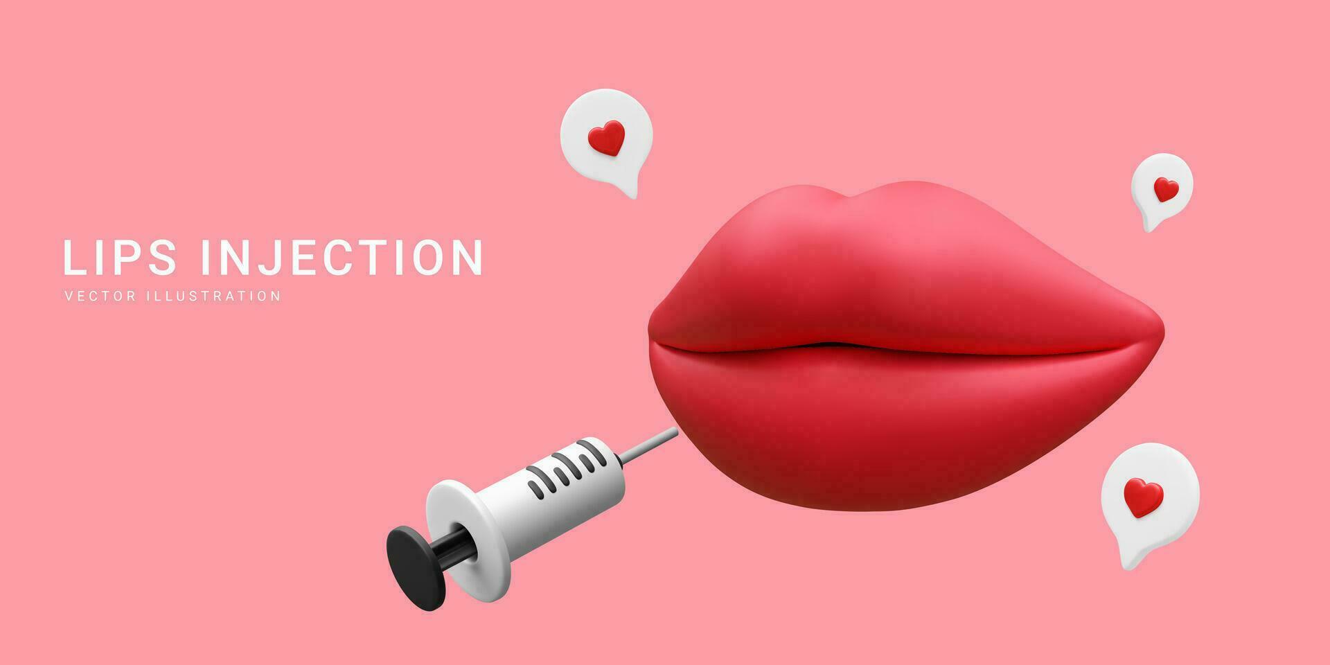 3d realistisch Banner zum Lippe Augmentation Verfahren. Lippen Injektion von hyaluronic Säure. Schönheit Klinik Konzept. Vektor Illustration