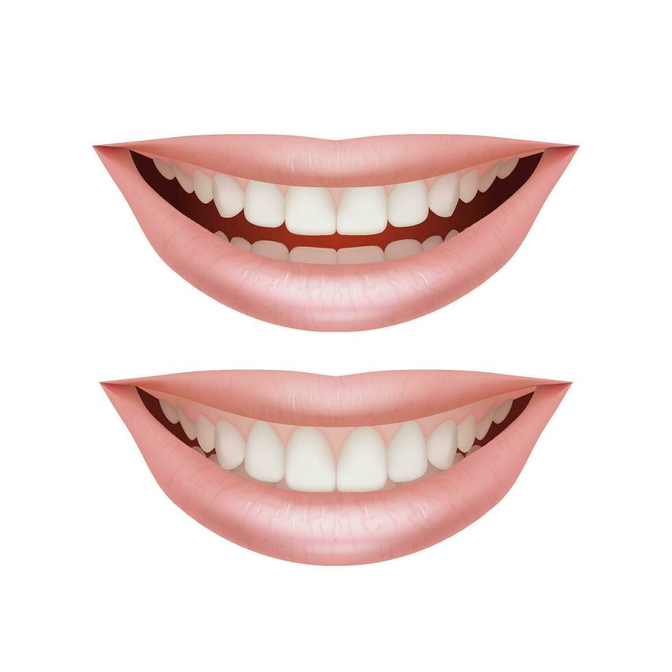 einstellen von 3d Abbildungen mit realistisch Lippen mit schön lächelt. Sammlung Vitrinen das Anatomie von gesund Zähne und Dental Pflege. zum Dental Kliniken, Zahnärzte, und Kieferorthopädie, bilden vektor