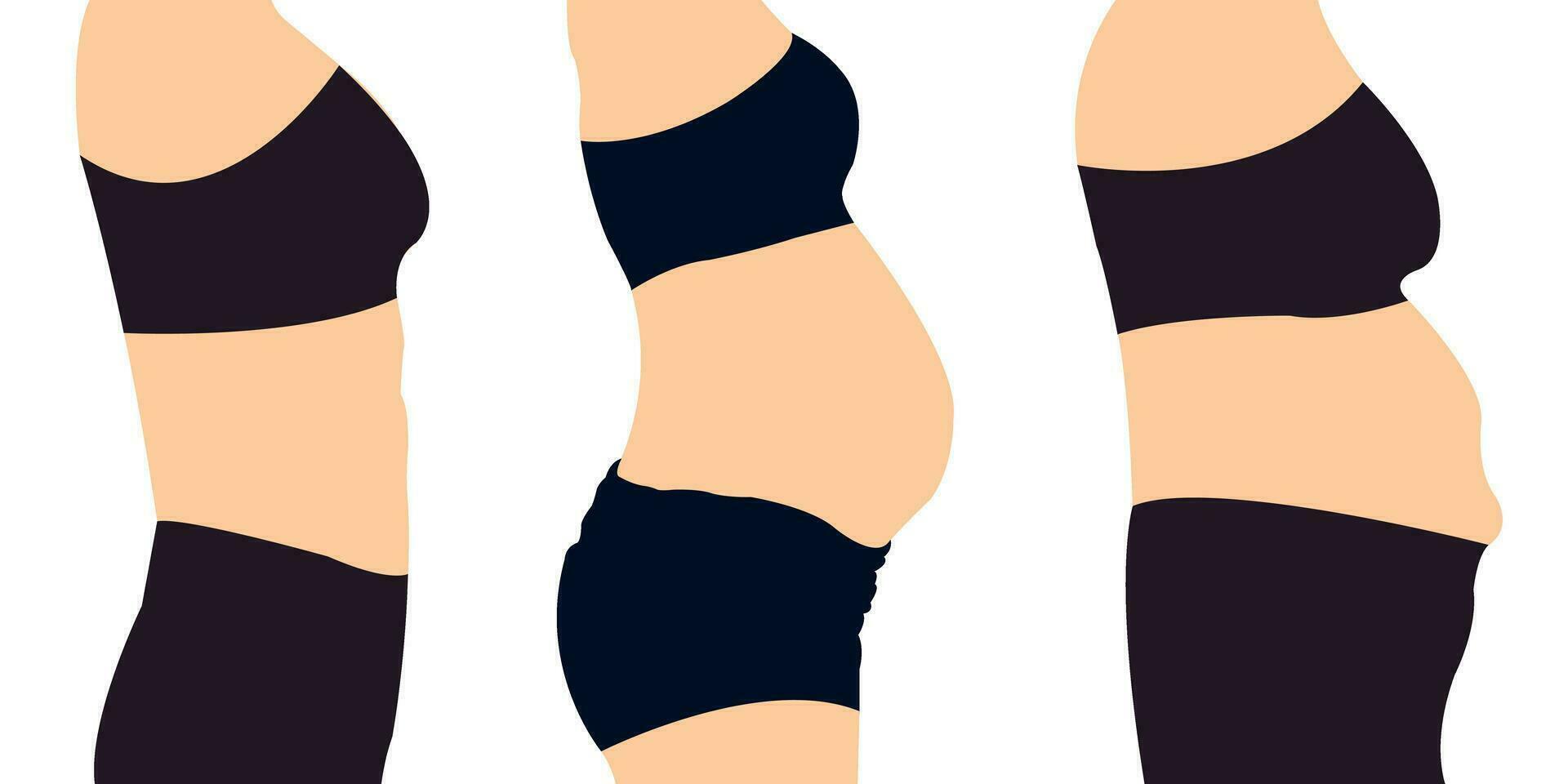 Frauen Bauch Bauch stecken schlaff Haut weiblich Körper Abdomen. Alkohol hormonell betont Mama Schürze Durchhängen hervorstehend oberflächlich Bauch demonstrieren Fettabsaugung. Diät Gewicht Verlust Fett Bauch schlank Bauch vektor