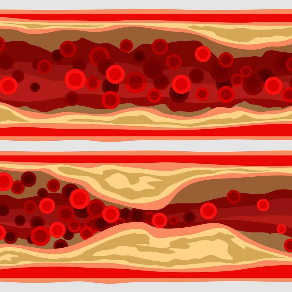 Arterie einstellen mit Blut Zellen vektor