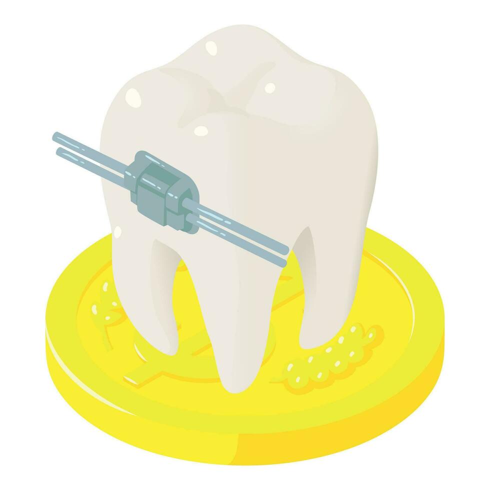 ortodontisk begrepp ikon isometrisk vektor. dental spänna på tand nära guld mynt vektor