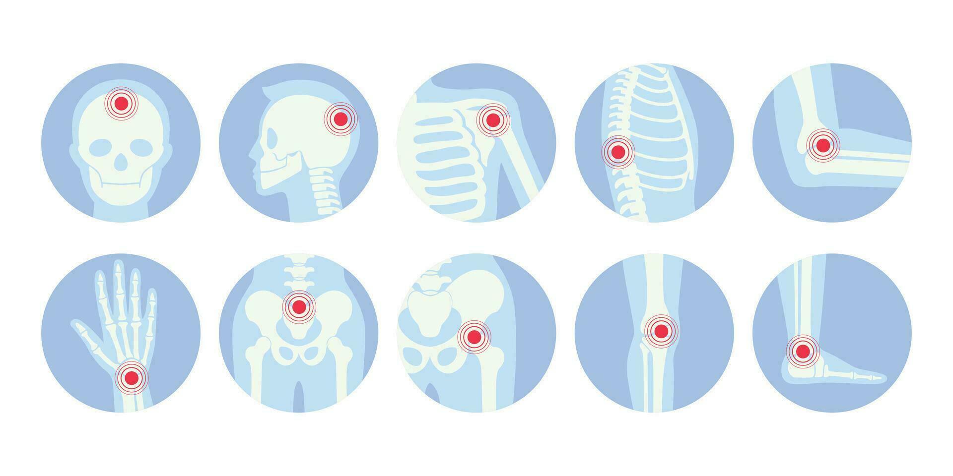 mänsklig skelett smärta poäng ikon uppsättning vektor platt illustration