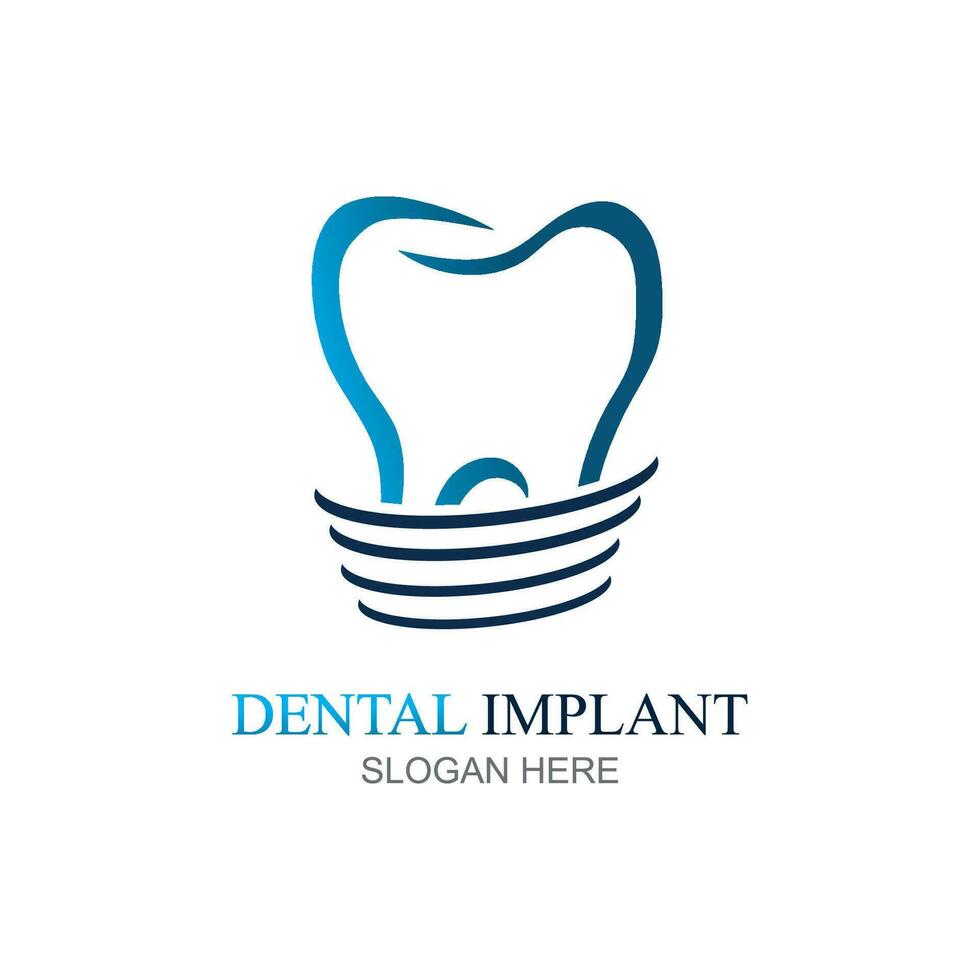 Dental implantieren Logo Design Konzept Vektor, Dental Pflege Logo Vorlage vektor