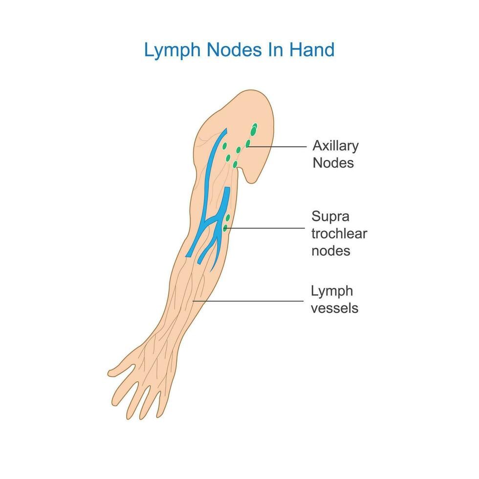 Lymphe Knoten Anatomie. beschriftet Diagramm zeigen das Lymphe Knoten im Hand. vektor