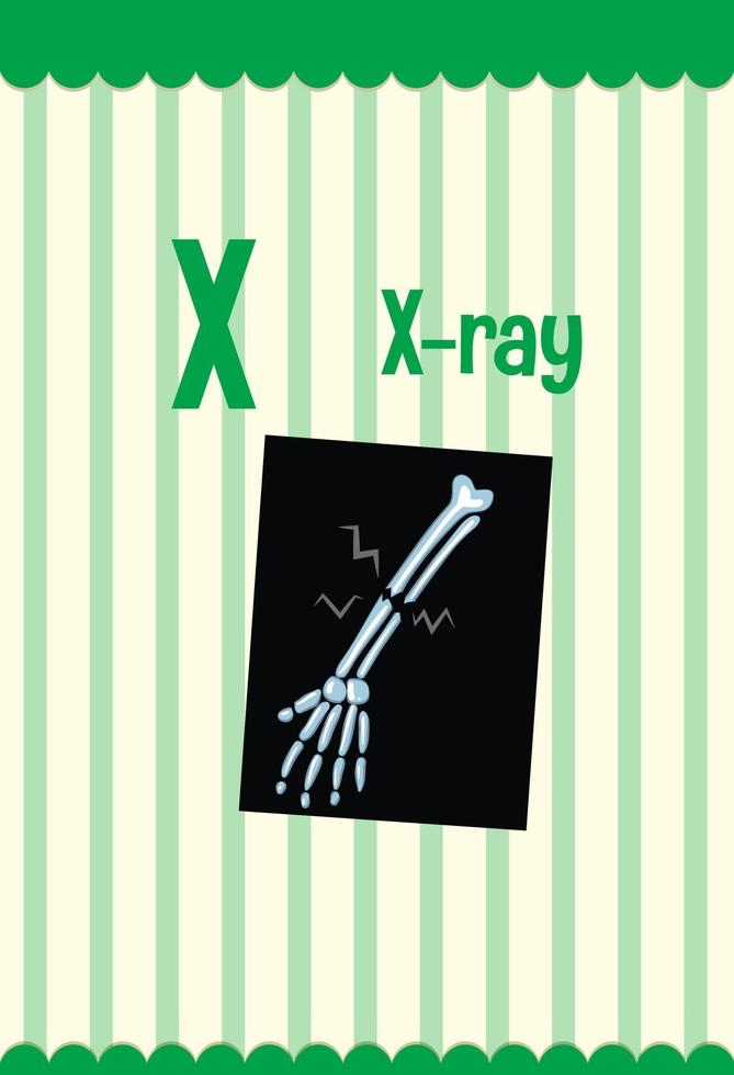 Alphabet Flashcard mit Buchstaben x für Röntgen vektor