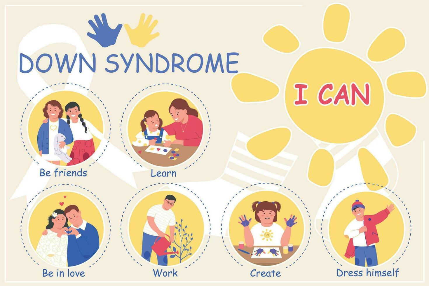 Downs Syndrom eben Infografik vektor